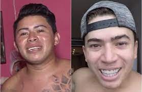 Whindersson nunes é um garoto do piauí com 25 anos e dono do maior canal do youtube brasileiro. Cover E Fa Do Whindersson Cearense Homenageia Youtuber Com Tatuagem Oitomeia