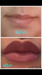The best lips in life are worth waiting for Marisol C Beauty Goals Aesthetic Care