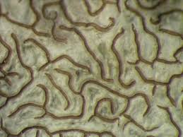 Image result for Grammitis