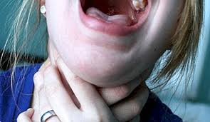 Baterai memang menjadi salah satu sektor penting dalam sebuah smartphone. Bagaimana Untuk Menjaga Tekak Petua Yang Sihat 2021