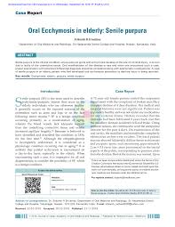 However, solar purpura and skin cancer are entirely different conditions. Pdf Oral Ecchymosis In Elderly Senile Purpura