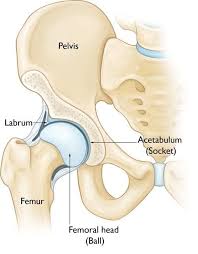 Sitting for long periods can lead to the gluteal muscles atrophying through constant pressure and disuse. Hip Arthritis Gormack Orthopaedics