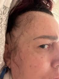 Anything I need to know about coloring post chemo? She said her hair is 3-4”