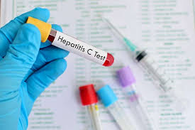 If you do, hepatitis signs and symptoms can include: Kennst Du Den Unterschied Zwischen Hepatitis A B C D Und E Fit For Fun