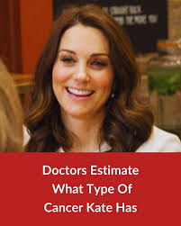What Type Of Cancer Did Kate Middleton Have Based On Doctors Estimates:  https://bit.ly/4cPlGIZ