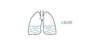 Image result for Diffusing Capacity