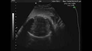 In The Utero An Infant Stock Footage Video 100 Royalty Free 9228377 Shutterstock