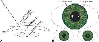 Ea ed ee ef eg ek en es et ev ex ea eb ec ed ee ef eg eh ej ek el em en eq er es et ev ew gr gs gv gx gy gz hg hh hi. Dual Purkinje Dpi Eye Tracking Methods A As Incoming Light Enters Download Scientific Diagram