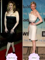 Pin On Weightloss Inspiration