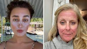Wearing sunscreen is key to this and doctors have now warned against a dangerous tiktok trend although using spf to contour may lead to temporary tan lines in areas where you would usually. Doctors Warn Against The Sunscreen Contouring Tiktok Trend Dublin S Q102