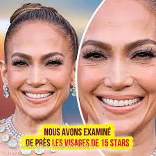 Lien en commentaire 👇