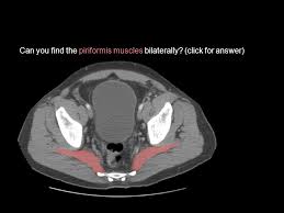 Contraction of the rectus abdominis muscles also compresses abdominal viscera and contributes to forced expiration. Axial Pelvic Ct These Are Axial Ct Images Starting Superior And Working Inferior This Powerpoint Consists Of Two Sets Of Images One Labeled With Questions Ppt Video Online Download