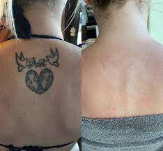 Search only for tattoo removeal My Tattoo Removal Experience Beauty And The Blonde