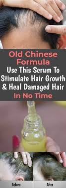 About 35% of these are hair treatment, 6% are hair loss products, and 4% are castor oil. Old Chinese Formula Use This Serum To Stimulate Hair Growth Heal Damaged Hair In No Tim Stimulate Hair Growth Stimulate Hair Regrowth Hair Growth Treatment