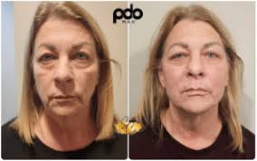 An Advocate for Unity: Shaun Spanos' Calling to Bridge Medical Aesthetics  in Massachusetts