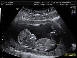 When Did I Get Pregnant Or Conceive Wehavekids