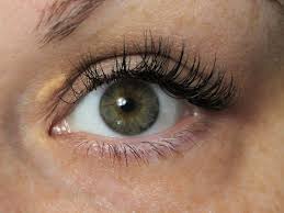 Image result for xanthelasma of eyelid