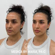 Maria Pavia, PA-C l Facial Balancing (@medicabymaria_pa) • Instagram photos  and videos