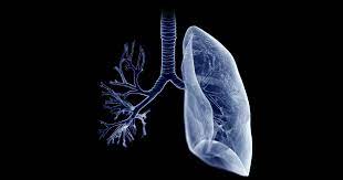 Symptoms of cystic fibrosis depend on which organs are affected and the severity of the condition. Triple Therapy Improves Fev1 In Patients With Cystic Fibrosis Advanced Lung Disease