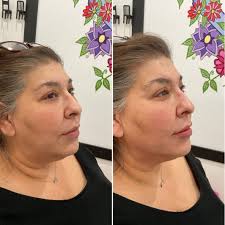 Beverly Hills Aesthetic Medics