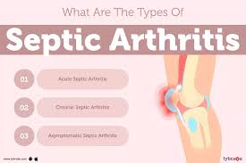 Image result for Septic Joint
