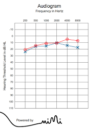 The resound online hearing test is a quick way to gauge how well you're hearing. Hearing Testing With Cell Phone