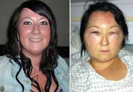 Kandeej Com Warning Can Your Hair Dye Can Kill You Safe Hair Dye Dyed Hair Hair Dye Allergy