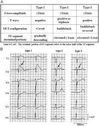 The wild species is considered to be endangered as only. Ecg Interpretation In Brugada Syndrome Sciencedirect