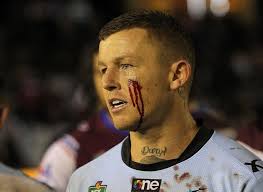 Match Gallery Sharks v Manly Sea Eagles