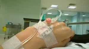 Infusion selfie est évalué 5.0 de 5 de 1. Sommer Sonne Krankenhaus Sudwarts