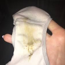 How to get a boyfriend. Boyfriend Fingered Me Last Night And I Woke Up With This In My Underwear Anyone Else Get This Glow Community
