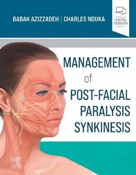 Management of Post-Facial Paralysis Synkinesis