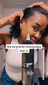 Revitalize your hairline with the power of Kerry Berry’s Growth Oil! Our  vegan, handmade, plant-powered formula is designed to combat hair loss,  thinning edges, and dry scalp, promoting longer, ...