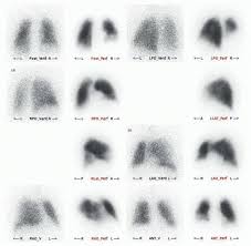 Pulmonary System Radiology Key