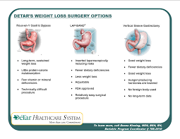 weight loss surgery comparison chart www bedowntowndaytona com