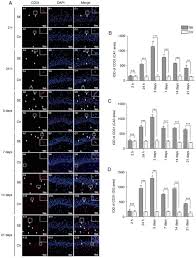 Bundan dolayı kas ağrılarını giderir, kas ağrılarında kuvvetli analjezik etki yapar. Changes In The Expression Of Endothelial Monocyte Activating Polypeptide Ii In The Rat Hippocampus Following Status Epilepticus