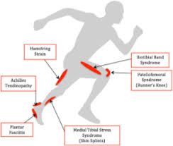 Image result for Running Injury
