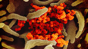 IMAGES: What New Coronavirus Looks Like Under The Microscope : NPR