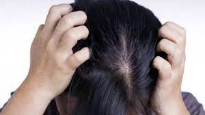 Si parla di una perdita che sta tra . Bimru5are0dsm