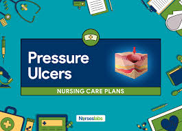 Expected outcomes nursing interventions risk for social isolation. 3 Pressure Ulcer Bedsores Nursing Care Plans Nurseslabs