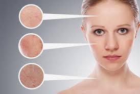 Les points noirs, qu'on appelle également comédons, surviennent lorsque les pores de la peau sont obstrués par un excès de sébum et de cellules on retrouve principalement les points noirs dans les régions où se situent les glandes sébacées, qui produisent le sébum. Bien Nettoyer La Peau Pour Eliminer Les Points Noirs Pores Dilates