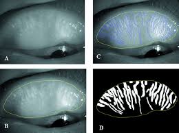 Image result for Dissotis glandulosa