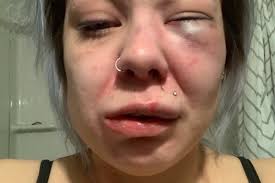 Fundraiser for Mikayla Prell by Katarina Tzortzis-Chapman : Helping Mikayla  Rise Again