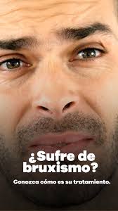 Bruxismo Diurno