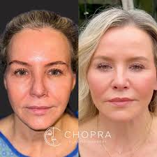 Welcome to another episode of Myth-Busting Fridays! 🧐 Myth: Labiaplasty is  only for aesthetic reasons. 💡 Truth: While it's a cosmetic procedure,  labiaplasty offers real functional benefits that patients love. Let's break