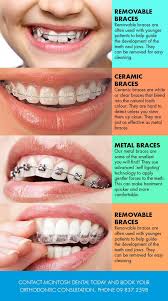 Braces Colors Black And Blue What Colors Of Braces Should You Choose Dental Braces Ceramic Braces Teeth Braces