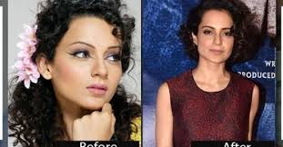 Were They Like This In The Past Seven Bollywood Superheroes Before And After Cosmetic Surgery Mix India Preity zinta is one of the celebrities that possibly love plastic surgery.