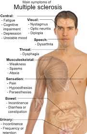 Some ms symptoms that may appear in all people, including males, include: Multiple Sclerosis Ms