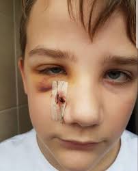 Autistic boy, 11, tried to kill himself after bullies beat him with metal  pole