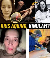 Kris Aquino SHUTS DOWN Dark Rumors
